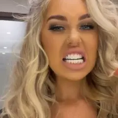 Kobieta z blond włosami prezentuje swoje idealne, białe tureckie zęby, uśmiechając się szeroko.