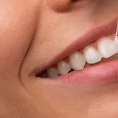 Zbliżenie na usta i czyszczenie zębów narzędziem dentystycznym.