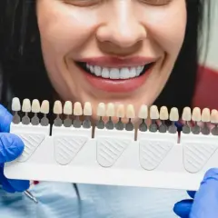 Uśmiechnięta kobieta z idealnymi zębami, dentysta dobiera kolor licówek. Sprawdź, jaka jest licówki cena.