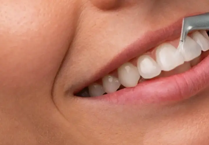Zbliżenie na usta i czyszczenie zębów narzędziem dentystycznym.